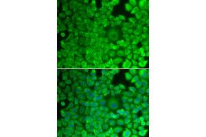 Immunofluorescence analysis of HeLa cells using GYS1 antibody (ABIN5971351). (Glycogen Synthase 1 anticorps)