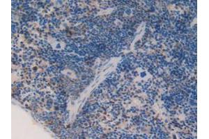 IHC-P analysis of Mouse Spleen Tissue, with DAB staining. (C1QA anticorps  (AA 23-245))