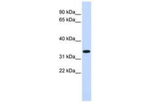 Image no. 1 for anti-Tripartite Motif Containing 14 (TRIM14) (AA 204-231) antibody (ABIN6740402) (TRIM14 anticorps  (AA 204-231))