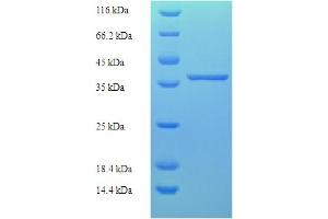 SDS-PAGE (SDS) image for MLX Interacting Protein (MLXIP) (AA 1-217), (full length) protein (His-SUMO Tag) (ABIN5711763)