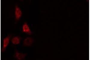 ABIN6275664 staining  HeLa cells by IF/ICC. (UBE2D2 anticorps  (C-Term))