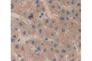 IHC-P analysis of Human Tissue, with DAB staining. (RBP4 anticorps  (AA 18-201))