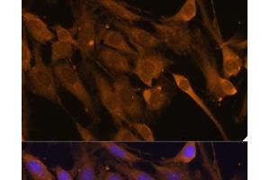 Immunofluorescence analysis of C6 cells using STUB1 Polyclonal Antibody at dilution of 1:100 (40x lens). (STUB1 anticorps)