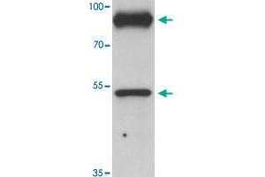 Western blot analysis of PRICKLE1 in human bladder tissue with PRICKLE1 polyclonal antibody  at 1 ug/mL. (PRICKLE1 anticorps  (C-Term))