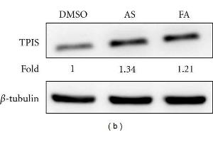 Analysis of the results of 2D PAGE by immunoblotting and ROS assay. (TPI1 anticorps  (C-Term))