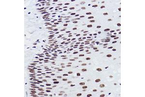 Immunohistochemistry of paraffin-embedded human esophageal using BRMS1 Rabbit mAb (ABIN7265928) at dilution of 1:100 (40x lens).
