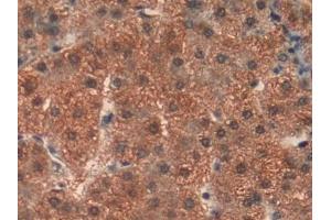 Detection of PHB in Human Liver Tissue using Polyclonal Antibody to Prohibitin (PHB)