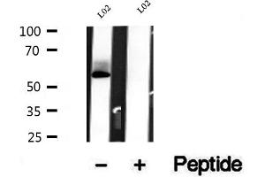 Western blot analysis of extracts of L02 cells, using BCO2 antibody. (BCO2 anticorps  (Internal Region))