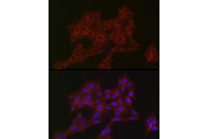 Immunofluorescence analysis of PC-12 cells using  Rabbit mAb (ABIN7265385) at dilution of 1:100 (40x lens). (ARPC2 anticorps)