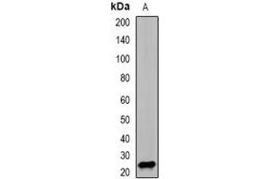 Western blot analysis of PSMD10 expression in SW620 (A) whole cell lysates. (PSMD10 anticorps)