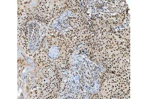 IHC analysis of RING2/RING1B/RNF2 using anti-RING2/RING1B/RNF2 antibody (ABIN7599286). (RNF2 anticorps  (AA 1-336))