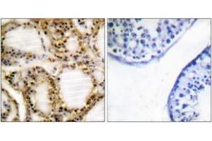 Immunohistochemistry analysis of paraffin-embedded human testis, using Retinoblastoma (Phospho-Thr821) Antibody. (Retinoblastoma Protein (Rb) anticorps  (pThr821))