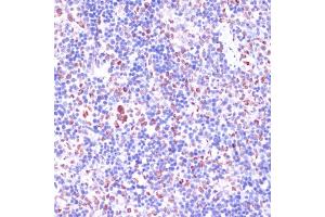 Immunohistochemistry of paraffin-embedded rat spleen using KDM1 antibody (ABIN7268323) at dilution of 1:100 (40x lens).