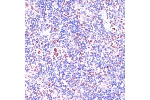 Immunohistochemistry of paraffin-embedded rat spleen using KDM1 antibody (ABIN7268323) at dilution of 1:100 (40x lens). (LSD1 anticorps  (AA 130-380))