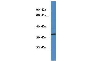 Western Blotting (WB) image for anti-Golgin A6 Family-Like 2 (GOLGA6L2) (Middle Region) antibody (ABIN2788891) (GOLGA6L2 anticorps  (Middle Region))