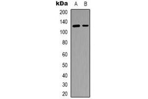 Western blot analysis of SFRS15 expression in RT4 (A), Colo205 (B) whole cell lysates. (SCAF4 anticorps)