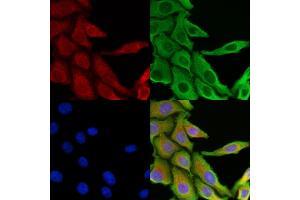 ABIN6266031 and ABIN6269398 staining HepG2 cells by IF/ICC. (WNK1 anticorps  (N-Term))