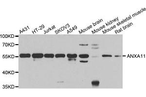Western blot analysis of extracts of various cell lines, using ANXA11 antibody. (Annexin A11 anticorps)