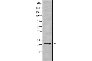 Western blot analysis of TMEM37 using HUVEC whole cell lysates (TMEM37 anticorps  (N-Term))