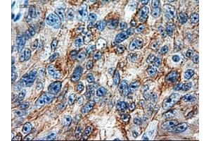 Immunohistochemical staining of paraffin-embedded colon using anti-KRT18 (ABIN2452646) mouse monoclonal antibody. (Cytokeratin 18 anticorps  (AA 69-372))