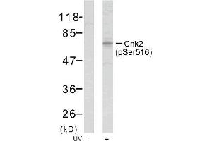Image no. 1 for anti-Checkpoint Kinase 2 (CHEK2) (pSer516) antibody (ABIN196866) (CHEK2 anticorps  (pSer516))