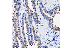 Immunohistochemistry of paraffin-embedded rat lung using SCGB1 antibody (6997) at dilution of 1:100 (40x lens).