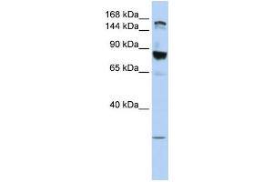 WB Suggested Anti-TJP2  Antibody Titration: 0. (TJP2 anticorps  (Middle Region))