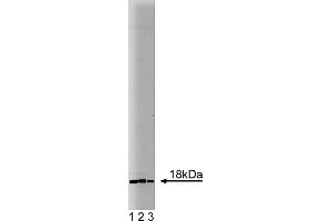 Western Blotting (WB) image for anti-Ubiquitin-Conjugating Enzyme E2I (UBE2I) (AA 26-156) antibody (ABIN968155)