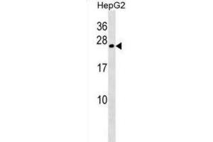 Western Blotting (WB) image for anti-Crystallin, gamma B (CRYGB) antibody (ABIN2998589)