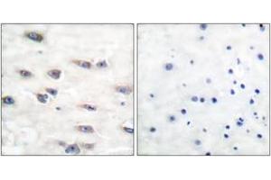 Immunohistochemistry analysis of paraffin-embedded human brain, using Trk A (Phospho-Tyr791) Antibody.