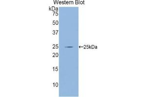 Detection of Recombinant GCLC, Mouse using Polyclonal Antibody to Glutamate Cysteine Ligase, Catalytic (GCLC) (GCLC anticorps  (AA 435-636))