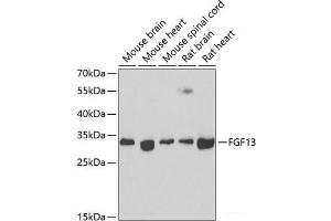 Western blot analysis of extracts of various cell lines using FGF13 Polyclonal Antibody at dilution of 1:1000. (FGF13 anticorps)