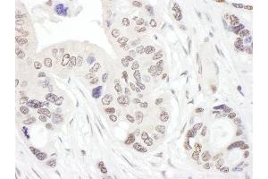 Immunohistochemistry (IHC) image for anti-NHP2 Non-Histone Chromosome Protein 2-Like 1 (NHP2L1) (AA 71-121) antibody (ABIN7453472)