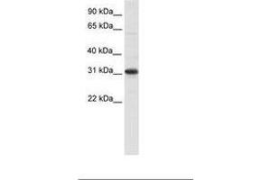 Image no. 1 for anti-Nuclear Receptor Interacting Protein 2 (NRIP2) (AA 27-76) antibody (ABIN6736079) (NRIP2 anticorps  (AA 27-76))
