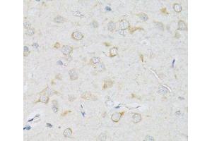 Immunohistochemistry of paraffin-embedded Rat brain using SLC2A13 Polyclonal Antibody at dilution of 1:100 (40x lens). (SLC2A13 anticorps)