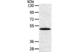 Western blot analysis of Human placenta tissue, using SMOC2 Polyclonal Antibody at dilution of 1:250