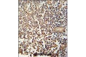 MCA1 Antibody (C-term) (ABIN390679 and ABIN2840973) immunohistochemistry analysis in formalin fixed and paraffin embedded human lymphnode followed by peroxidase conjugation of the secondary antibody and DAB staining. (MCA1 anticorps  (C-Term))