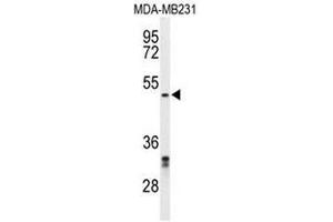 Western blot analysis of CBX2 Antibody (N-term) in MDA-MB231 cell line lysates (35µg/lane). (CBX2 anticorps  (N-Term))
