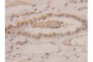 Detection of GAPDH in Human Kidney Tissue using Polyclonal Antibody to Glyceraldehyde-3-Phosphate Dehydrogenase (GAPDH) (GAPDH anticorps  (AA 2-148))