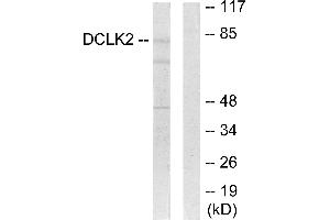Western blot analysis of extracts from HepG2 cells, using DCLK2 antibody.