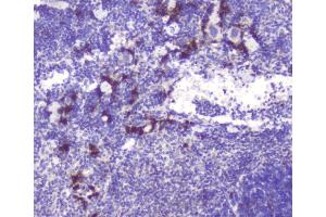 IHC analysis of RASAL1 using anti-RASAL1 antibody (ABIN6719367). (RASAL1 anticorps  (AA 721-798))