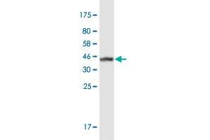 Western Blot detection against Immunogen (37.