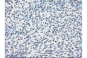 Image no. 1 for anti-Crystallin, alpha B (CRYAB) antibody (ABIN1497647)