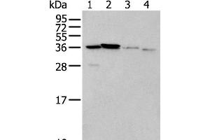 Western blot analysis of 293T cell Mouse brain tissue and Human kidney tissue lysates using LASP1 Polyclonal Antibody at dilution of 1:350 (LASP1 anticorps)