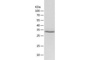 AMMECR1-Like (AMMECR1L) (AA 1-310) protein (His-IF2DI Tag)
