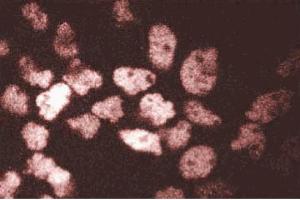 Immunofluorescent staining of A431 cells. (ARNT anticorps  (AA 461-574))