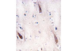 anti-Unc-51 Like Kinase 2 (ULK2) (AA 235-264), (N-Term) antibody