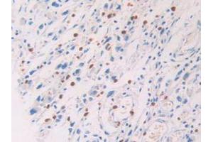 IHC-P analysis of Human Stomach Tissue, with DAB staining. (PROS1 anticorps  (AA 481-667))