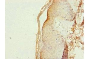 Immunohistochemistry of paraffin-embedded human skin tissue using ABIN7151127 at dilution of 1:100