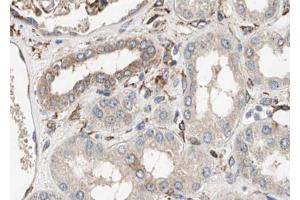ABIN6267450 at 1/100 staining human kidney tissue sections by IHC-P. (NFKBIA anticorps  (pTyr305))
